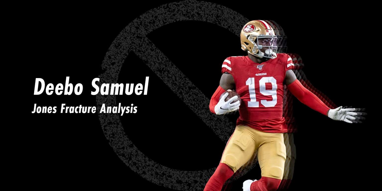 Deebo Samuel suffers foot fracture in group throwing session with